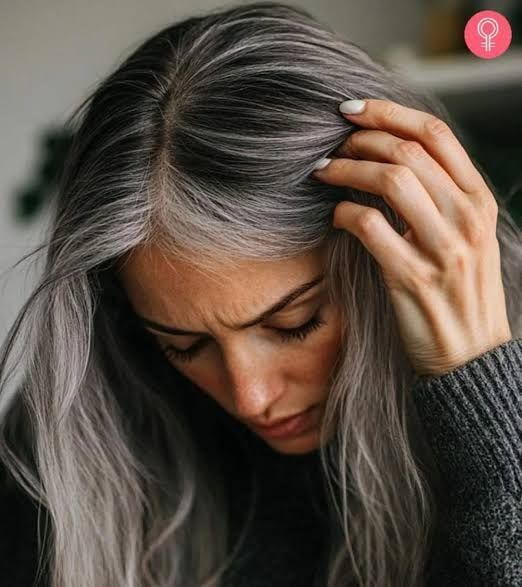 Premature Graying of Hair